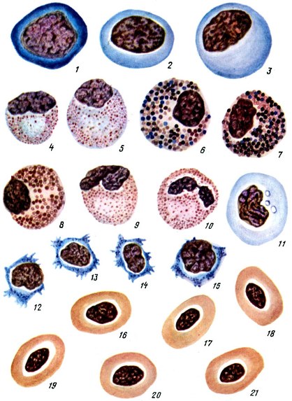 Таблица II. Кровь карпа в норме: 1 - гемоцитобласт; 2 - миелобласт; 3- промислоцит; 4 - нейтрофильный миелоцит: 5 - нейтрофильный, 6, 7 - базофильные и 8 - псевдозоэозинофильный метамиелоциты; 9, 10 - налочкоядерный и сегментноядерный нейтрофилы; 11 - моноцит; 12 - 15 - лимфоциты; 16 - 21 - эритроциты