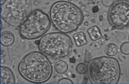 Bloom of dinoflagellates (Prorocentrum minimum) in Italian coastal waters, caused by organic pollution (x1 000) (Photo: P. Giordano)