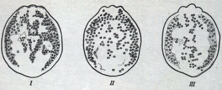 Возбудители диплостоматоза - метацеркарии: I - Diptostomum baeri; II - Diplosiomum indistinctum; III - Diplostomum spathaceum (по Шигину)